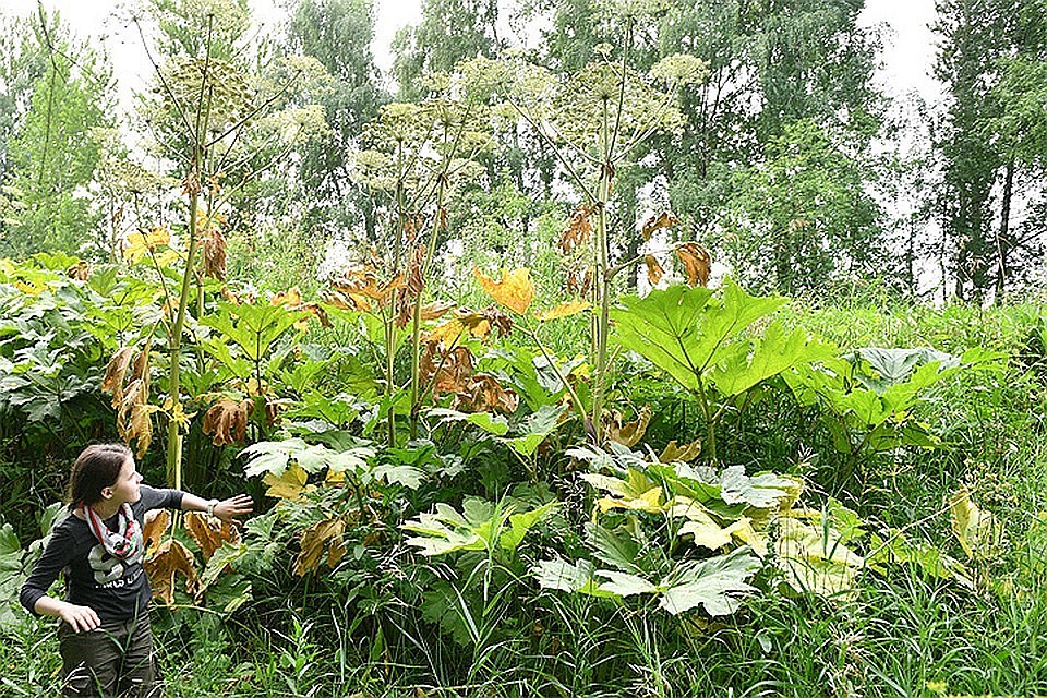От борщевика у людей страшные ожоги