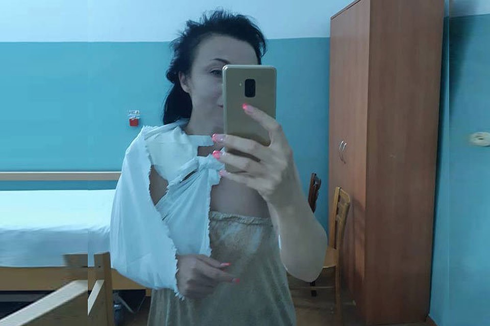 Ангелина после операции
