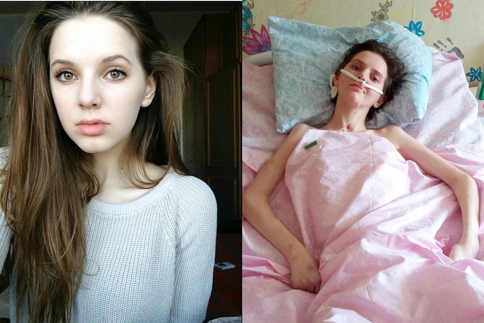 Еще год назад Катя строила планы на будущее, сейчас девушка мечтает об одном - научиться ходить.