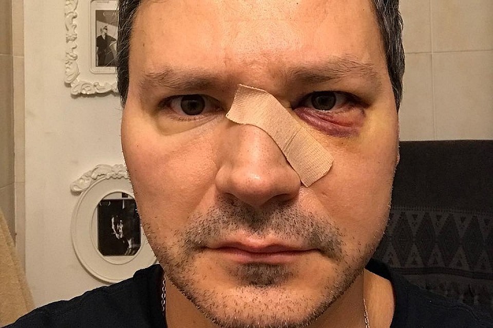 Актер Александр Дзюба подрался с коллегой по театру Романа Виктюка. Фото: Личная страничка в соцсетях героя публикации.
