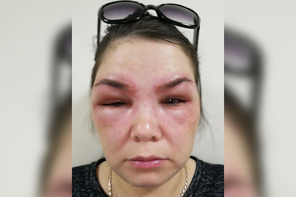 Уфимка оказалась в больнице после безобидной процедуры