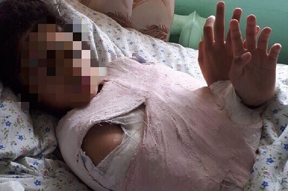 В Ноябрьске прокуратура ищет виновных в происшествии на детской площадке Фото: группа "Происшествия Ноябрьск" vk.com