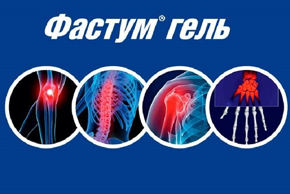 Фастум® гель