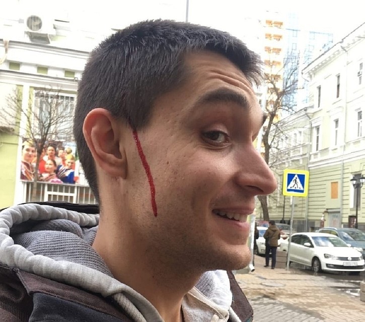 Ростовчанин не стал огорчаться ране и сделал веселое селфи. Фото: https://vk.com/rostovnadonu