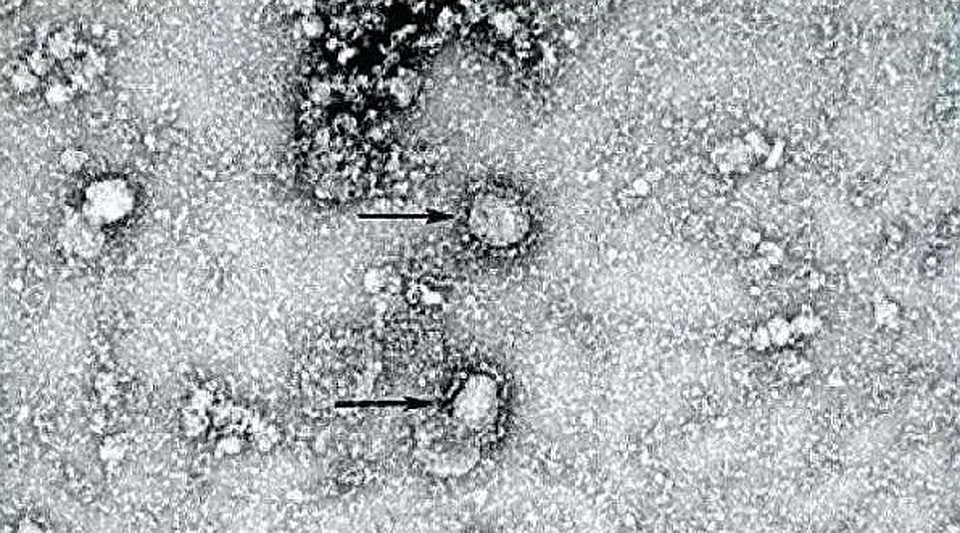 Фото: The Chinese disease prevention authority