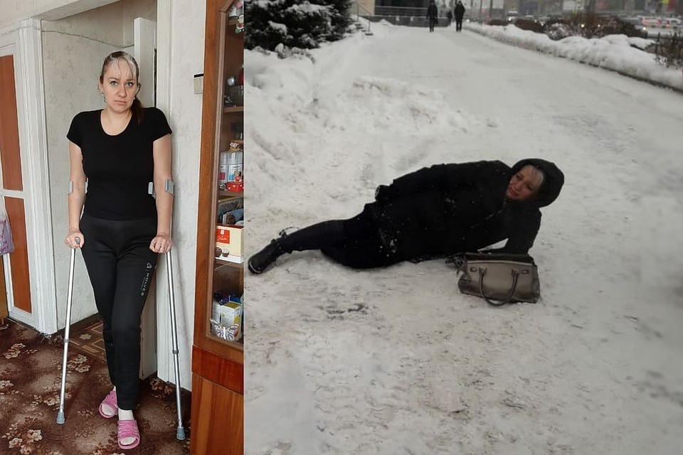 Сибирячка упала и сломала ногу из-за гололеда. Фото: личный архив.