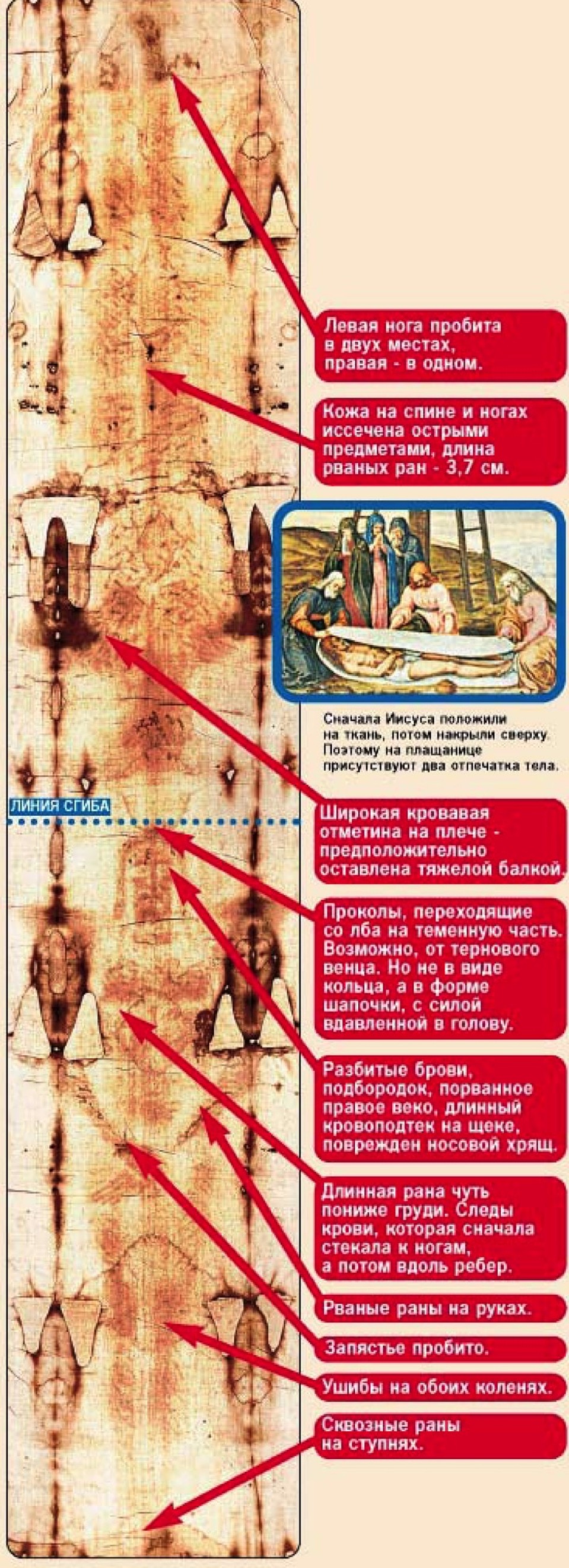 Раны, которые можно различить на теле, отпечатавшемся на Туринской плащанице.