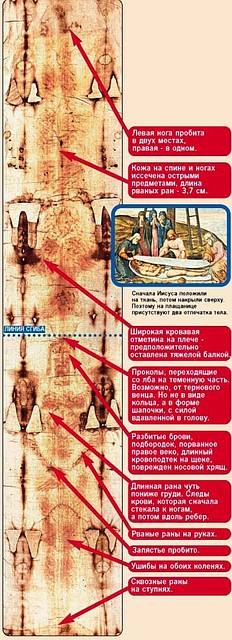 Раны, которые можно различить на теле, отпечатавшемся на Туринской плащанице.