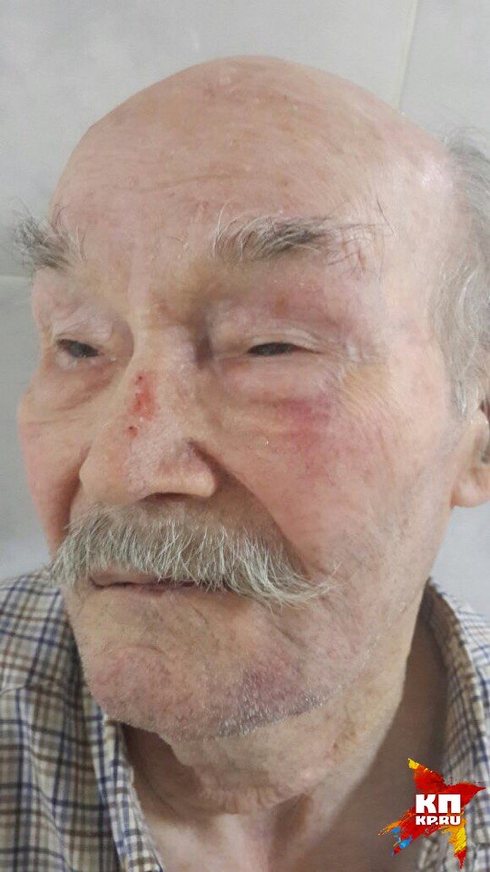 Ханиф Сидтиков после избиения находится в больнице