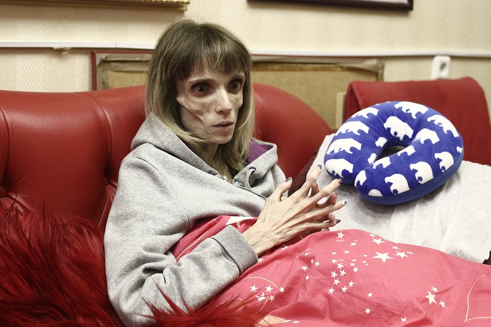 В 26 лет Кристина весит 17 килограммов Фото: Роман ИГНАТЬЕВ