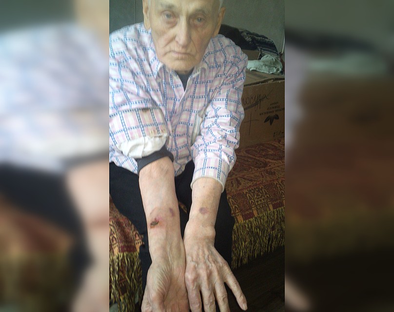 Вот такие раны получил Василий Николаевич. Фото Татьяны Ушаковой