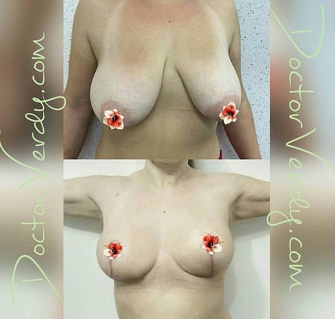 Вот так свою работу продемонстрировала сама хирург, отфотошопив снимки.