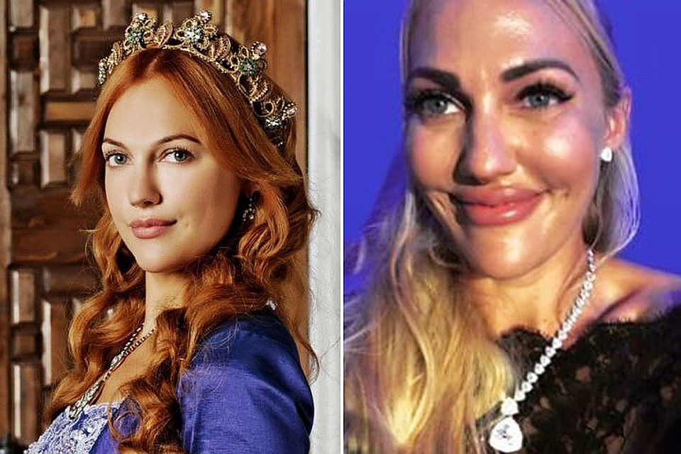 Два года назад Мерьем занялась усовершенствованием собственной внешности: накачала губы и скулы. Фото: Инстаграм.