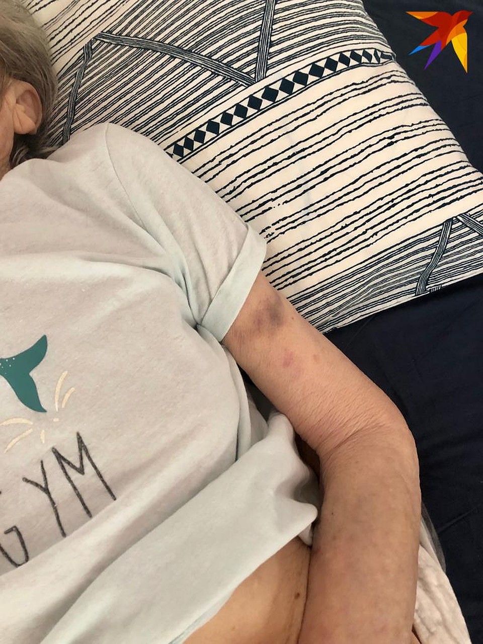 На теле Елены Андреевны были синяки