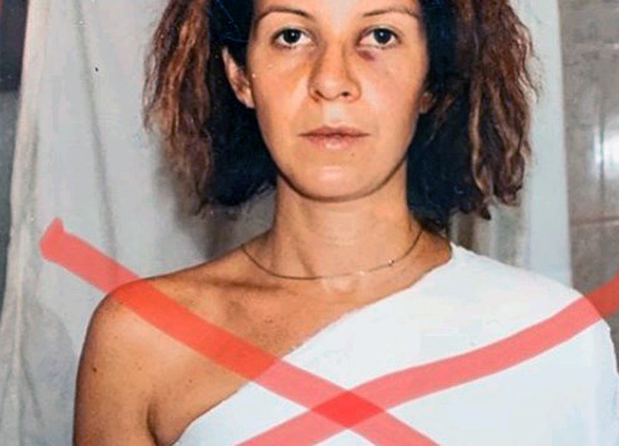 Наталья Штурм опубликовала фото с последствиями домашнего насилия. Фото: Личная страничка героя публикации в соцсети