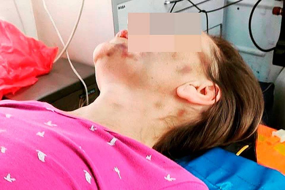 В больнице женщина оказалась в ужасном состоянии Фото: Личный архив