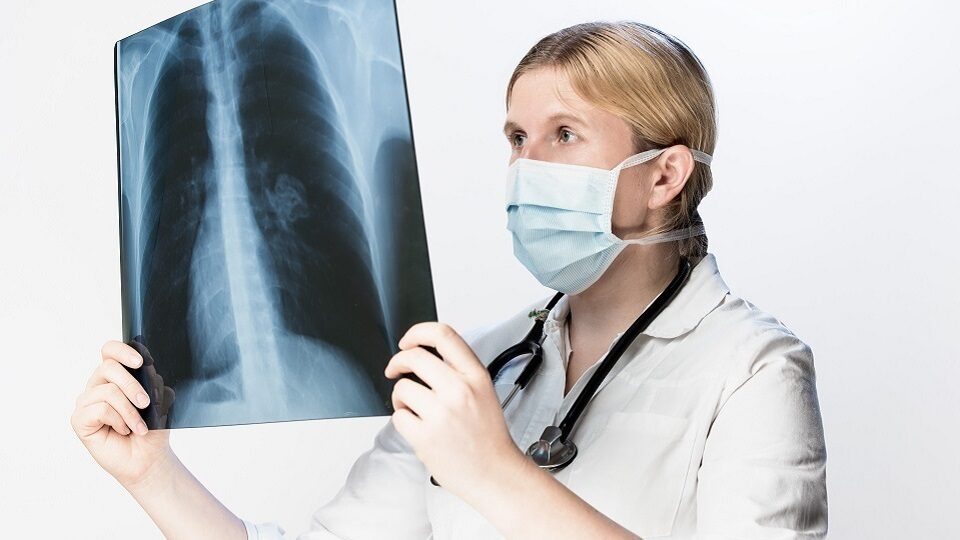 Тромбоэмболия легочной артерии