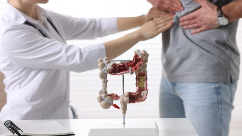 10+ вопросов врачу о полипах в кишечнике