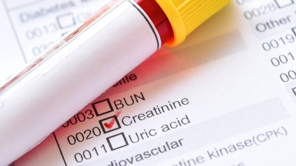 Креатинин в крови: что такое, функции, норма в крови, почему бывает ...