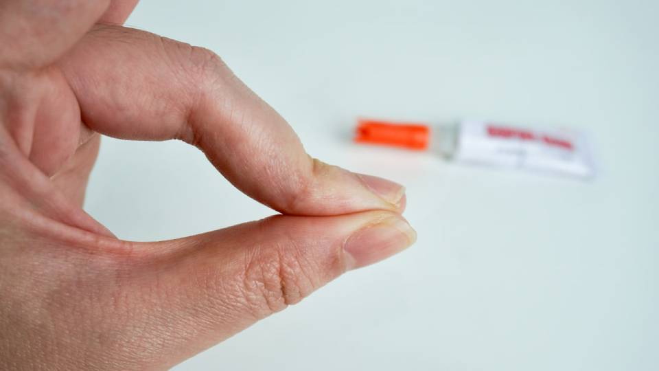 Как убрать суперклей с кожи взрослому